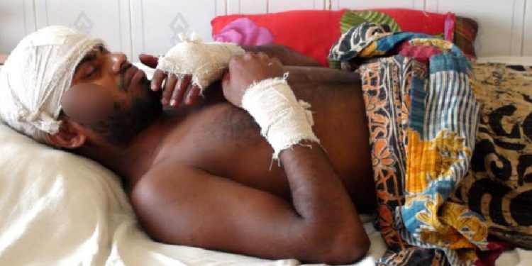 মেয়ের সঙ্গে প্রেমের সম্পর্ক,ধনবাড়ীতে ভাতিজাকে কোপালো চাচা!