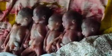 একসাথে ৫ সন্তানের জন্ম দিলেন ফারজানা