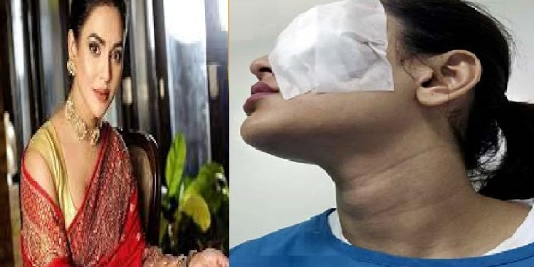 চোখের অপারেশন করালেন চিত্রনায়িকা নুসরাত ফারিয়া