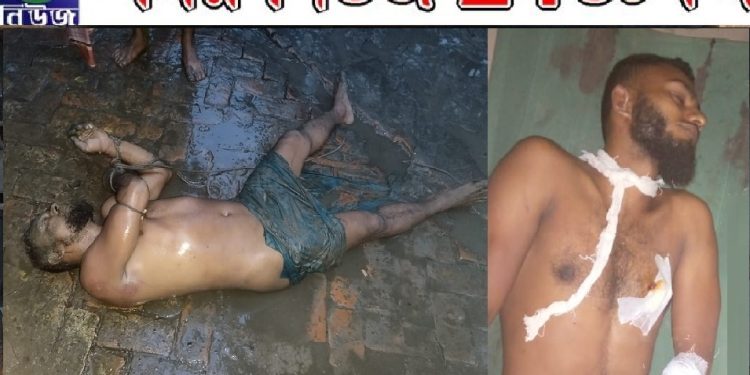 চুরি করতে গিয়ে যুবককে ছুরিকাঘাত, অতঃপর