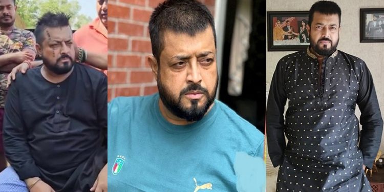 সাপের কামড়ে আহত ওমর সানী সুস্থ আছেন