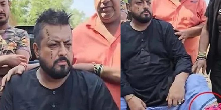 এক সময়ের জনপ্রিয় নায়ক ওমর সানী সাপের কামড়ে আহত