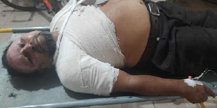 গাজীপুরে চলন্ত ট্রাকে পেট্রোল বোমা নিক্ষেপ, ট্রাক চালক ও সরকারি দগ্ধ
