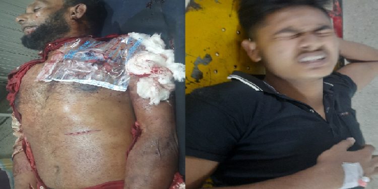 আনোয়ার টেক্সটাইল মিলে গ্যাস সিলিন্ডার বিস্ফোরণে নিহত-১,আহত-১
