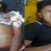 আনোয়ার টেক্সটাইল মিলে গ্যাস সিলিন্ডার বিস্ফোরণে নিহত-১,আহত-১