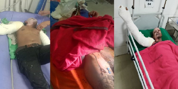 হাসনাবাদে পোষা পাখি ধরতে গিয়ে রেস্কিউ টিমের প্রধানসহ ৪জন সদস্য দগ্ধ