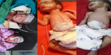 দেড় ঘণ্টার ব্যবধানে পাঁচ সন্তান প্রসব করেছেন এক নারী