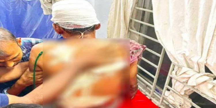 ওবায়দুল কাদেরের ভগ্নিপতি মনিরুজ্জামান মনিরকে কুপিয়ে জখম