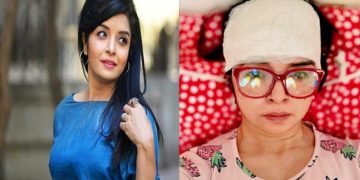 অভিনেত্রী এলিনা শাম্মী সড়ক দুর্ঘটনায় গুরুতর আহত, ১৫টি সেলাই লেগেছে কপালে