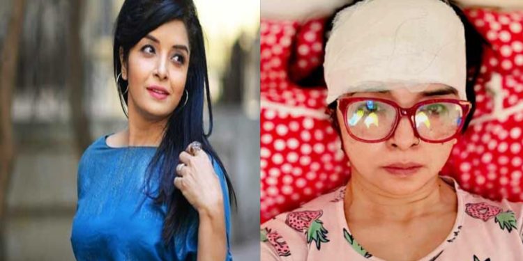 অভিনেত্রী এলিনা শাম্মী সড়ক দুর্ঘটনায় গুরুতর আহত, ১৫টি সেলাই লেগেছে কপালে